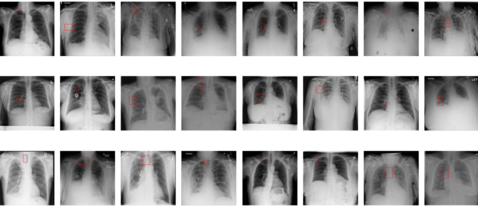 Computer vision (CV) in medical imaging